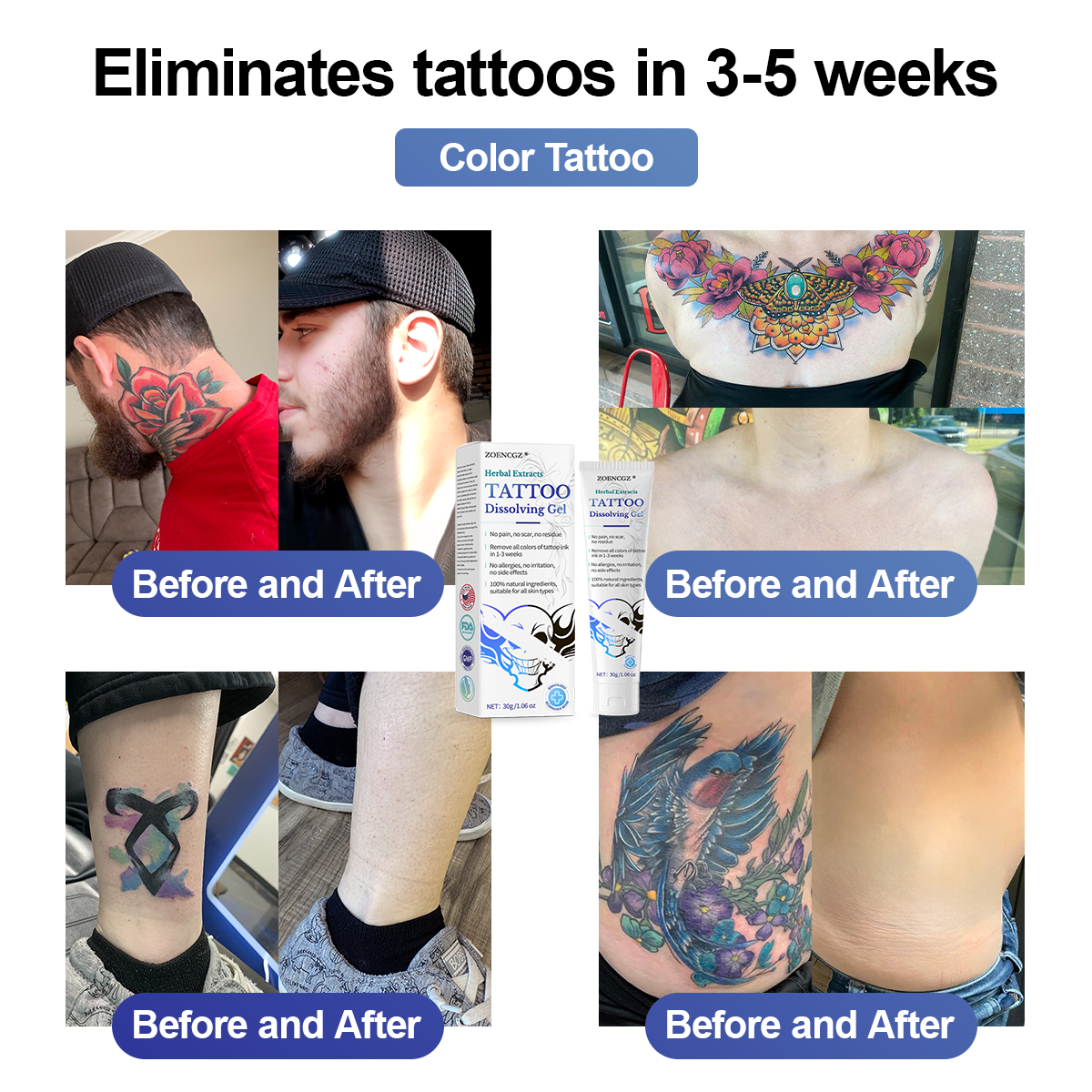 💁‍♀️𝐋𝐢𝐦𝐢𝐭𝐞𝐝 𝐭𝐢𝐦𝐞 𝐝𝐢𝐬𝐜𝐨𝐮𝐧𝐭 𝐬𝐚𝐥𝐞 🔥- 𝐙𝐎𝐄𝐍𝐂𝐆𝐙®  𝐇𝐞𝐫𝐛𝐚𝐥 𝐄𝐱𝐭𝐫𝐚𝐜𝐭𝐬 𝐓𝐚𝐭𝐭𝐨𝐨 𝐃𝐢𝐬𝐬𝐨𝐥𝐯𝐢𝐧𝐠 𝐆𝐞𝐥
