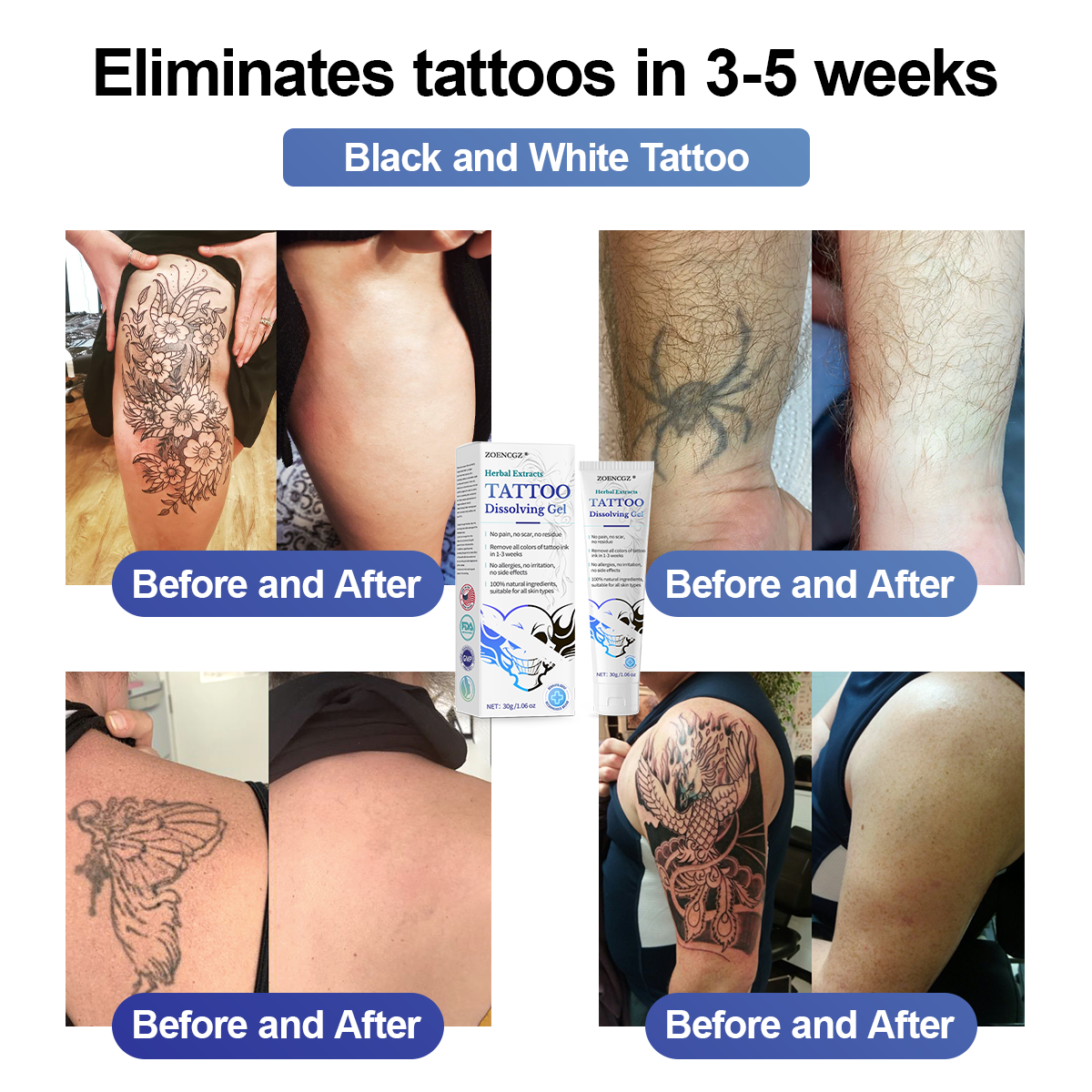 💁‍♀️𝐋𝐢𝐦𝐢𝐭𝐞𝐝 𝐭𝐢𝐦𝐞 𝐝𝐢𝐬𝐜𝐨𝐮𝐧𝐭 𝐬𝐚𝐥𝐞 🔥- 𝐙𝐎𝐄𝐍𝐂𝐆𝐙®  𝐇𝐞𝐫𝐛𝐚𝐥 𝐄𝐱𝐭𝐫𝐚𝐜𝐭𝐬 𝐓𝐚𝐭𝐭𝐨𝐨 𝐃𝐢𝐬𝐬𝐨𝐥𝐯𝐢𝐧𝐠 𝐆𝐞𝐥