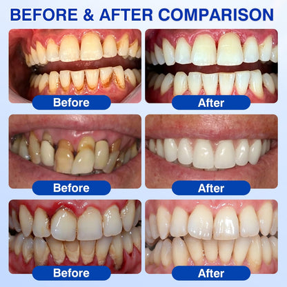 🇺🇸🦷🛡️𝐙𝒐𝒆𝒏𝒄𝒈𝒛® GumRevive Periodontal Repair Gel
