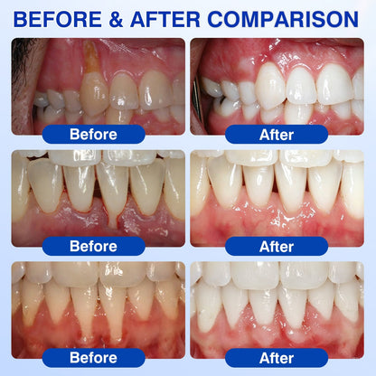 🇺🇸🦷🛡️𝐙𝒐𝒆𝒏𝒄𝒈𝒛® GumRevive Periodontal Repair Gel