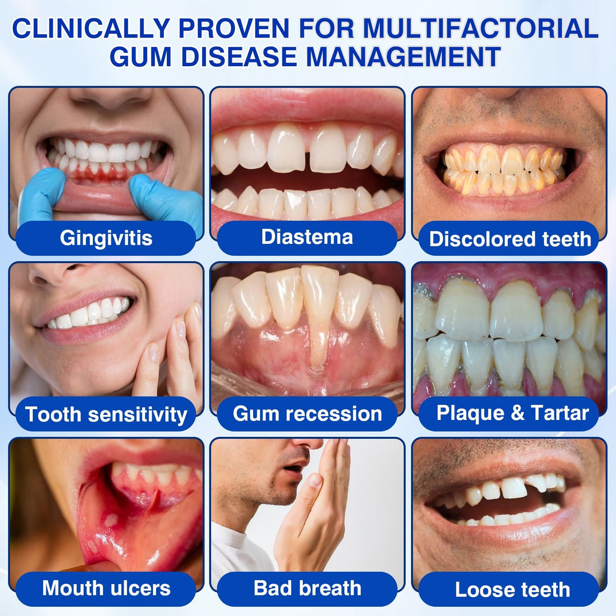 🇺🇸🦷🛡️𝐙𝒐𝒆𝒏𝒄𝒈𝒛® GumRevive Periodontal Repair Gel