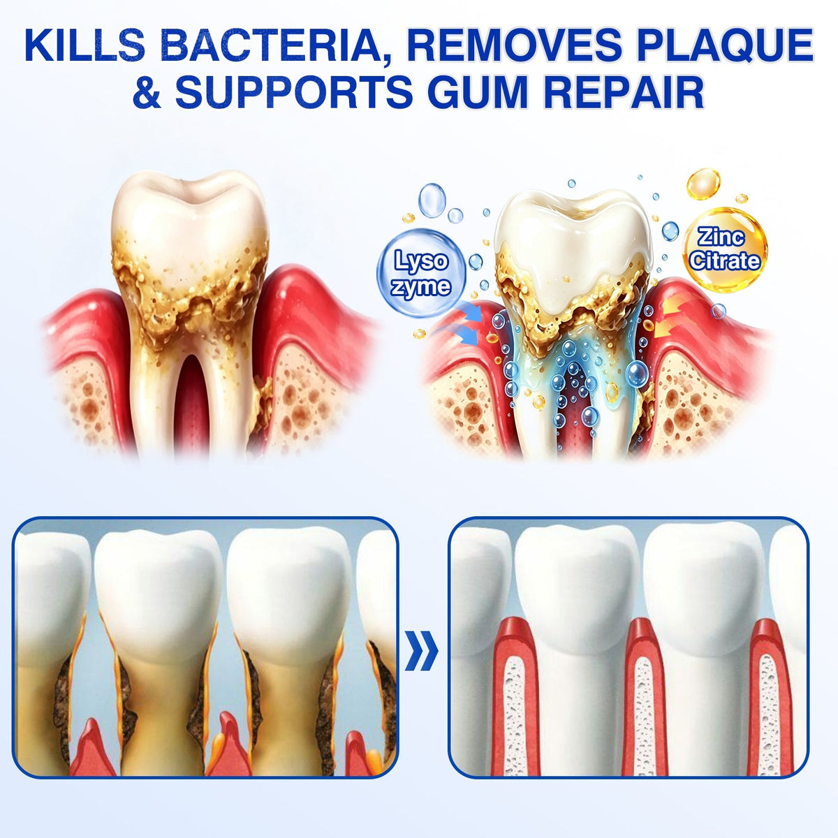 🇺🇸🦷🛡️𝐙𝒐𝒆𝒏𝒄𝒈𝒛® GumRevive Periodontal Repair Gel
