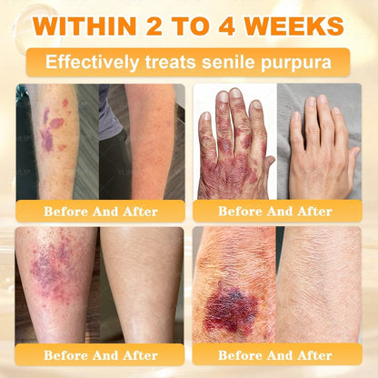【𝟐𝟎𝟐𝟔 𝐍𝐞𝐰 𝐔𝐩𝐠𝐫𝐚𝐝𝐞: 𝟖𝟎% 𝐎𝐅𝐅】📎📎🍯Aeehfeng® Bee Venom Skin Restoration Cream – with Royal Jelly, Hyaluronic Acid and Bee Venom for skin hydration, elasticity, anti-aging & repair