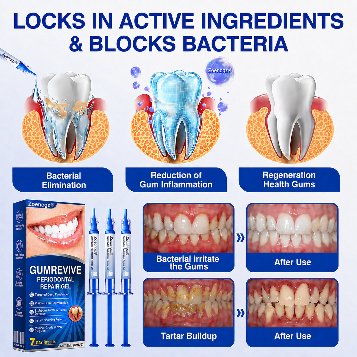 🇺🇸🦷🛡️𝐙𝒐𝒆𝒏𝒄𝒈𝒛® GumRevive Periodontal Repair Gel