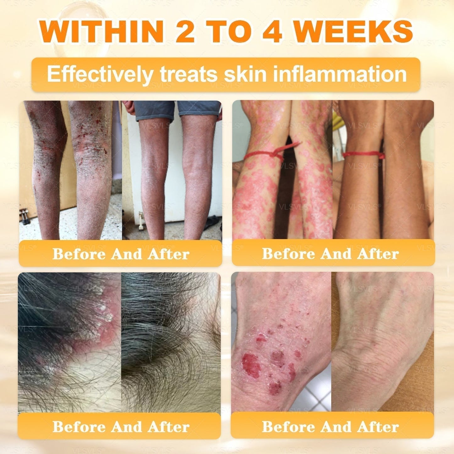 【𝟐𝟎𝟐𝟔 𝐍𝐞𝐰 𝐔𝐩𝐠𝐫𝐚𝐝𝐞: 𝟖𝟎% 𝐎𝐅𝐅】📎📎🍯Aeehfeng® Bee Venom Skin Restoration Cream – with Royal Jelly, Hyaluronic Acid and Bee Venom for skin hydration, elasticity, anti-aging & repair